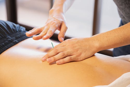 What to Expect at Your First Acupuncture Therapy Session | Heidigerber